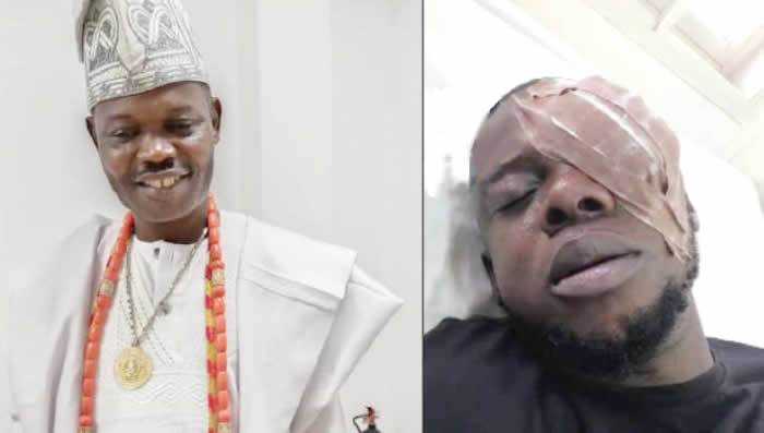 How Ogun monarch blinded trader for dancing with queen